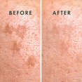 thumbnail image 5 of St. Moriz Advanced Self Tanner Face Mist Spray bronceador sin sol (mediano 5.07 onzas líquidas) – Spray bronceador transparente rápido con aloe vera y vitamina E – Autobronceador gradual para la cara, 5 of 5