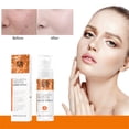 thumbnail image 1 of Spray Facial Hidratante | Bruma Facial Hidratante con Ácido Hialurónico y Extractos Vegetales | Absorción Profunda en la Piel | Antiinflamatorio y Calmante | Solución Portátil para Cuidado de la, 1 of 9