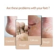 thumbnail image 2 of Horse Oil Hand Foot Cream Horse Anti Chafing Skin Repairing Moisturizer For Rough Dry And Cracked Chapped Feet Heel, 2 of 7