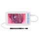 thumbnail image 1 of Otoscopio Otoscopio digital con 6 luces LED 32G TFcard 3.9 mmm 1080P Cámara de alcance de oído de alta definición Pantalla IPS de 4.3in Herramienta de eliminación de cerumen y espéculos para adultos Irfora Otoscopio, 1 of 7