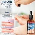 thumbnail image 5 of 10pcs Anti Nail Break Relief Oil 10ml, 5 of 5