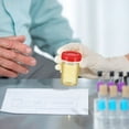 thumbnail image 2 of MesaSe 10 Pcs Urine Sample Bottles Specimen Pots Sample Collector Containers with Lids, 2 of 6