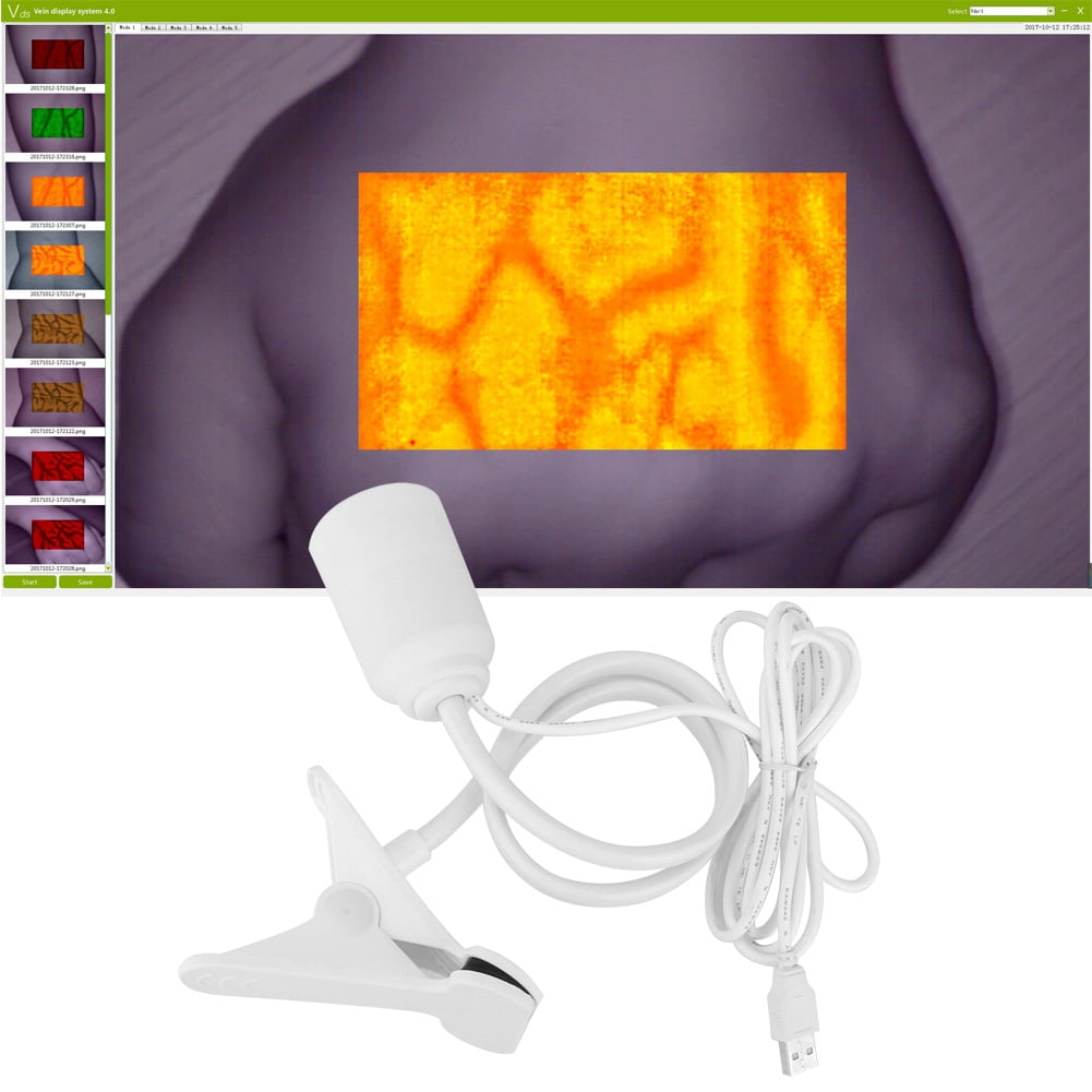 Vein Finder Lights Imaging Vein Finder Vein Finder Vein Lights Imaging