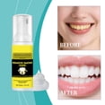 thumbnail image 1 of Mousse blanqueadora de dientes con lisosomas biológicos elimina manchas, 60 ml. Cuidado dental., 1 of 9