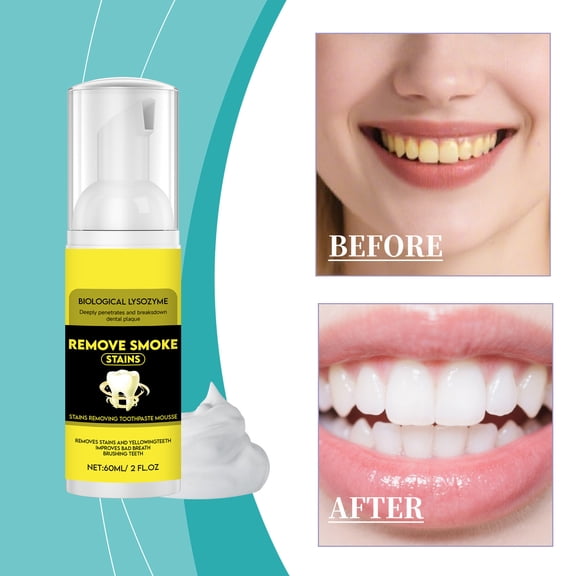 Teeth Whitening Foam Mousses,Instantly Remove For Yellow Stains,for Yellow & Sensitive Teeth,Teeth Whitening,Polish,Stain Remover