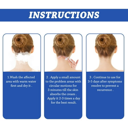 Yuxuan 50g/Box Itchy Skin Cream Non-irritating Easy to Absorb Healthy Safe Effective Anti-inflammatory Convenient Head Seborrheic Dermatitis Cream for Scalp