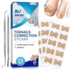 Ingrown Toenail Treatment, Toenail Fungus Treatment Extra Strength, Ingrown Toenail Removal Kit, 50PCS
