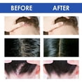 thumbnail image 4 of 2PCS Seborrheic Skin Cream Scalp Treatment Soothing Moisturizing Ointment 50g, 4 of 5