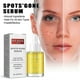 thumbnail image 1 of OUHOE Spot Fading Essence, Whitening Skin, Fading Dark Spots and Acne, Hydrating, Moisturizing and Anti-, 1 of 5