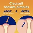 thumbnail image 3 of Limpiador facial Clearasil Stubborn Acne Control 5 en 1 x2, 3 of 9
