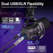 Socodox XLR/USB Dynamic Microphone Kit, PC Mic for Streaming,Podcasting,Gaming,RGB,Mute and Noise Cancelling Function,Volume Control,Headphone Jack