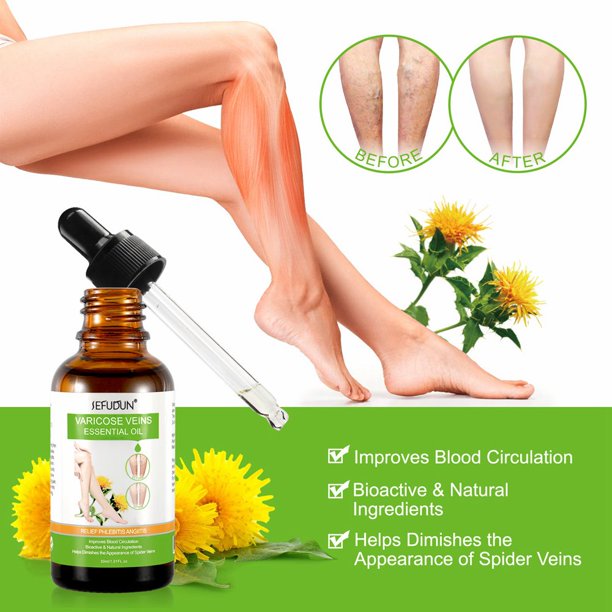 30ml Leg Foot Improve Blood Circulation Essential Oil Varicose Veins