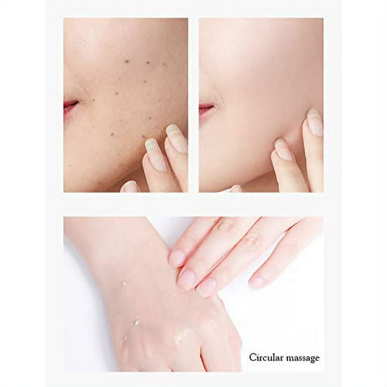 AICHUN BEAUTY Peeling Gel Face Body Removes Skin Aging AICHUN BEAUTY Peeling Gel Face Body Removes Skin Aging