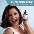 thumbnail image 3 of Sérum Eva Naturals Ácido Azelaico 10% con ácido hialurónico 60 ml, 3 of 9
