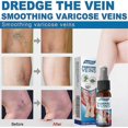 thumbnail image 5 of massage spray for varicose vein pain relief, 5 of 5