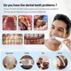 thumbnail image 2 of Removedor de cálculo Dental ultrasónico, escalador de placa Dental, eliminador de sarro, limpiador de manchas, eliminador de piedra Dental eléctrico, 2 of 5