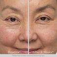 thumbnail image 4 of Obagi Nu-Cil Eyebrow Boosting Serum, 0.17 fl. oz., 4 of 8