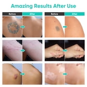 Tattoo Cover Up Concealer Makeup Waterproof,Tattoo Concealer,3 Colors Tattoo Cover Up,Cover Tattoos, Scars, Dark Spots, Vitiligo and Other Blemishes