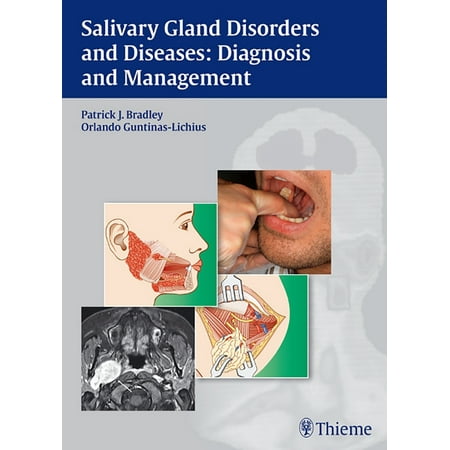 UPC: 9783131464910 | Salivary Gland Disorders and Diseases:: Diagnosis and Management (Hardcover)
