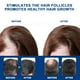 thumbnail image 4 of Crema contra la alopecia tu un 1 pieza alivia la caída del cabello y promueve el crecimiento, 4 of 5
