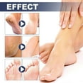 thumbnail image 5 of Teissuly Deodorant Foot Spray Keeps Fresh For Dry Crack Foot Odor 30ml, 5 of 9