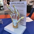 thumbnail image 2 of Modelo de Mano de Osteoartritis, Modelo de Patología de la Mano, Réplica de Anatomía y Fisiología , Modelo de Anatomía del Consultorio, 2 of 5