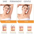 thumbnail image 4 of Laser Hair Removal | Permanent Painless Hair Removal for Women | IPL Hair Removal with Five Energy Levels and 999,999 Flashes | Epilation for Women and Men at Home, 4 of 5