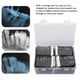 thumbnail image 4 of Bolsa protectora de película de rayos X 500 sobres de barrera dental que mantienen la limpieza para hospitales dentales ANGGREK Otros, 4 of 8