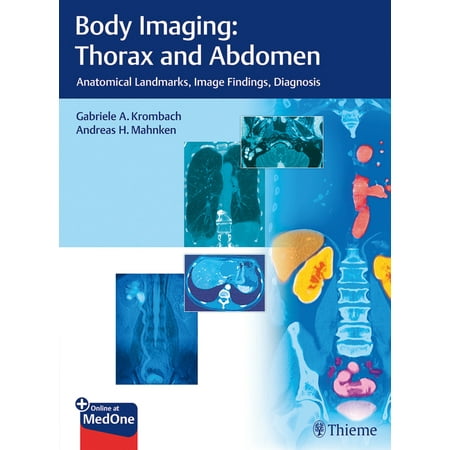UPC: 9783132054110 | Body Imaging: Thorax and Abdomen: Anatomical Landmarks  Image Findings  Diagnosis (Hardcover)