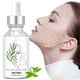 thumbnail image 2 of Buy 2 Save 10% Facial Essences With TeaTree Essences 30ml Essences Skin Essences To Tighten Pores, 2 of 9