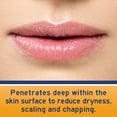 thumbnail image 5 of NEOSPORIN Lip Health Overnight Renewal Therapy Lip Protectant, 0.27 oz, 5 of 11