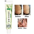 thumbnail image 1 of ZUDAIFU Crema a base de hierbas Psoriasis Antibacteriano Dermatiti Eczematoid Cuidado de la piel Ndcxsfigh Nuevos Originales, 1 of 9