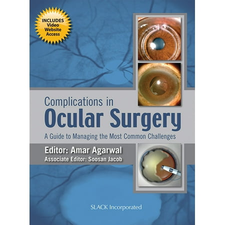 Complications in Ocular Surgery : A Guide to Managing the Most Common Challenges