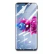 thumbnail image 5 of Micas De Hidrogel Delantera Y Trasera Para Zte Axon 11, 5 of 6
