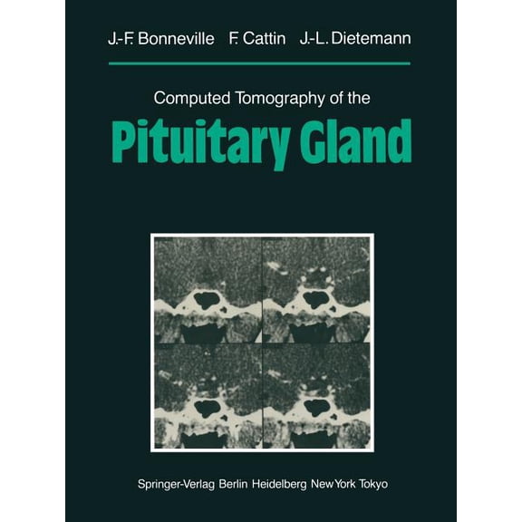 Computed Tomography of the Pituitary Gland: With a Chapter on Magnetic Resonance Imaging of the Sellar and Juxtasellar R, (Paperback)