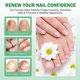 thumbnail image 3 of 1/2/3PCS Nail Fungus Treatment, Ginger Nail Fungus Treatment, Toenail Cuticle Care Oil Care, Fungal Nail Treatment, 7 Days Nail Fungus Treatment, 3 of 5