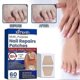 thumbnail image 3 of 60pcs Toenail Fungus Treatment Stickers Ingrowning Toenail Nail Repair Patch, 3 of 5