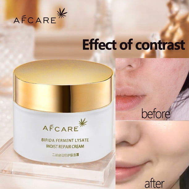 LAIKOU-crema Facial hidratante de Caracol Sakura, cremas de ácido hialurónico con vitamina C, antienvejecimiento, día y noche, cuidado de la piel"Snail" Fivean LED