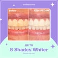 thumbnail image 3 of Kit de blanqueamiento dental Smileactives Complete 60 días con gel, 3 of 9