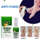 thumbnail image 3 of Eliminador Del Olor De Los Pies, Spray Para El Olor De Los Pies, Eliminación Del Sudor, Agradable Para La Piel, 30 Ml Para Uso Diario, 3 of 7