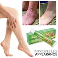 thumbnail image 3 of Crema eficaz para aliviar las varices, las arañas vasculares, la flebitis y la angiitis en las piernas, el cuerpo y los brazos, 3 of 8