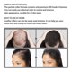 thumbnail image 5 of Rodillo para el crecimiento del cabello JAYSUING, rodillo de microagujas de titanio seguro e indolor Jaysuing Negro, 5 of 7