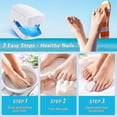 thumbnail image 5 of Nail Fungus Laser Treatment, Anti Fungal Laser-device, Finger Toe Nail Fungus Remover, Onychomycosis, 5 of 5
