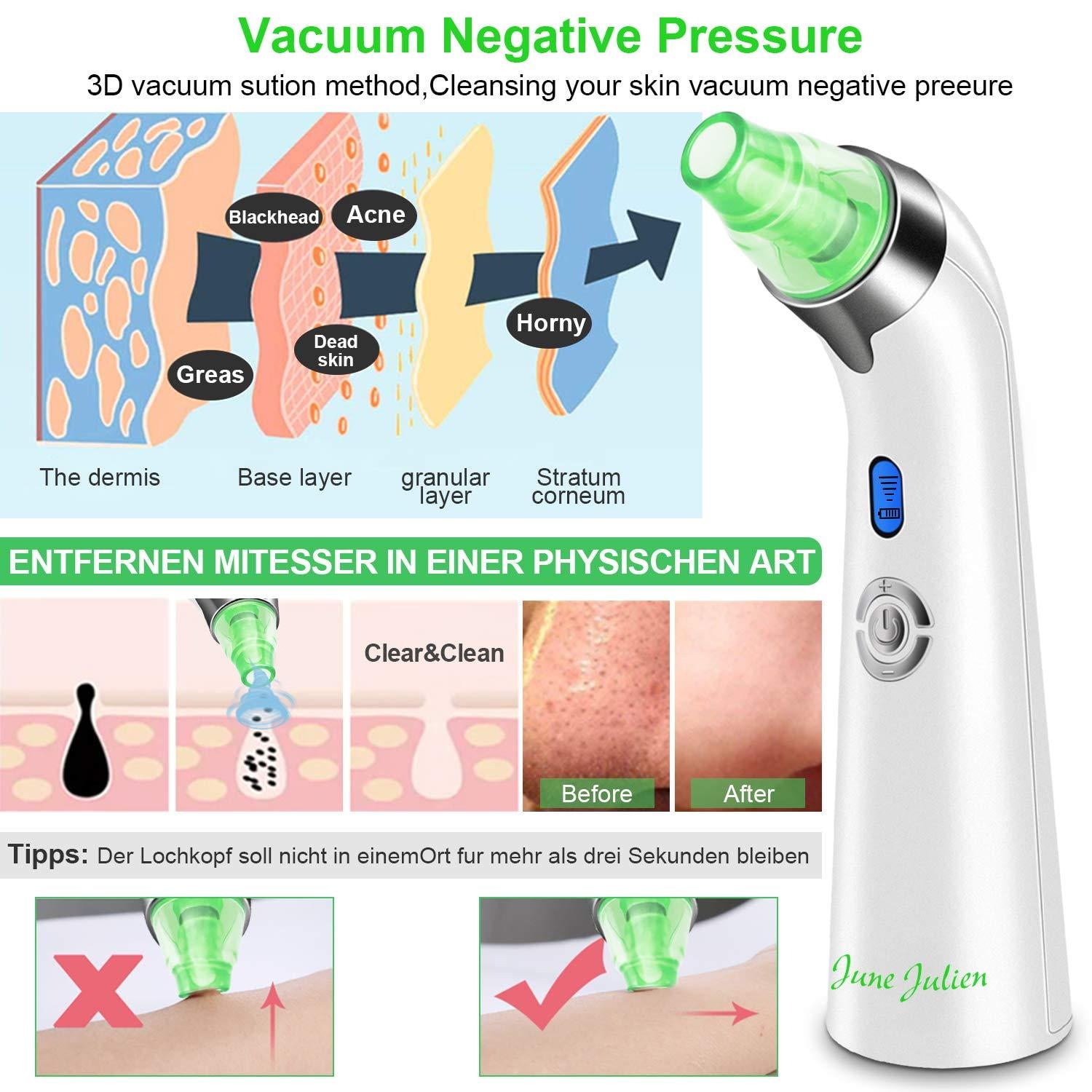 june julien blackhead remover