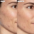 thumbnail image 3 of Sérum facial Sunday Riley Good Genes con ácido láctico todo en uno, 3 of 6