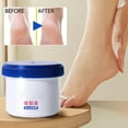 thumbnail image 5 of HYLLai Foot Care Ointment for Dry Cracked Skin, Intensive Moisturizing Balm to Repair Rough Heels and Soften Calluses Effectively, 50ml, 5 of 9