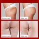 thumbnail image 5 of Crema Reafirmante y Tensora de Caderas 60 G | Reduce La Flacidez, Aumenta La Elasticidad, Hidrata y Cuida La Piel | 1 Unidad, 5 of 5