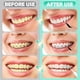 thumbnail image 3 of 100PCS Interdental Brushes for Teeth Cleaning with Soft and Bendable Bristles Oral Picks Flossers Cleaning Tools, 3 of 5