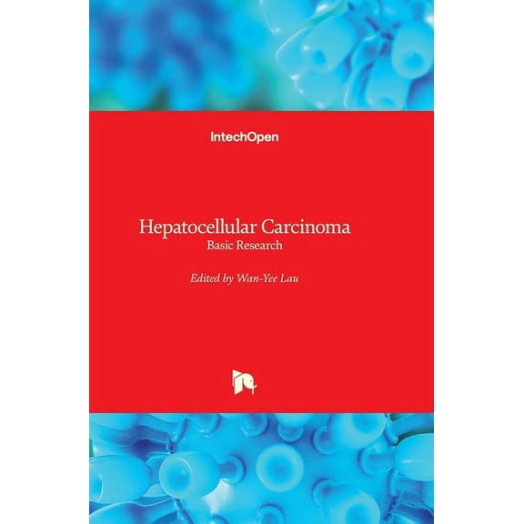 Hepatocellular Carcinoma: Basic Research (Hardcover)