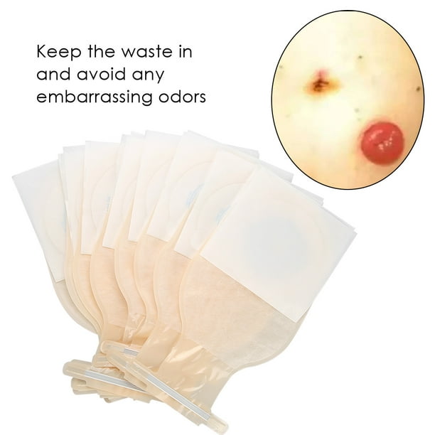 Fosa Ostomy Pouch,10pcs/Pack One-piece System Ostomy Bag Medicals Drainable Pouch  Colostomy Bag Ostomy Supplies, Colostomy Bag 